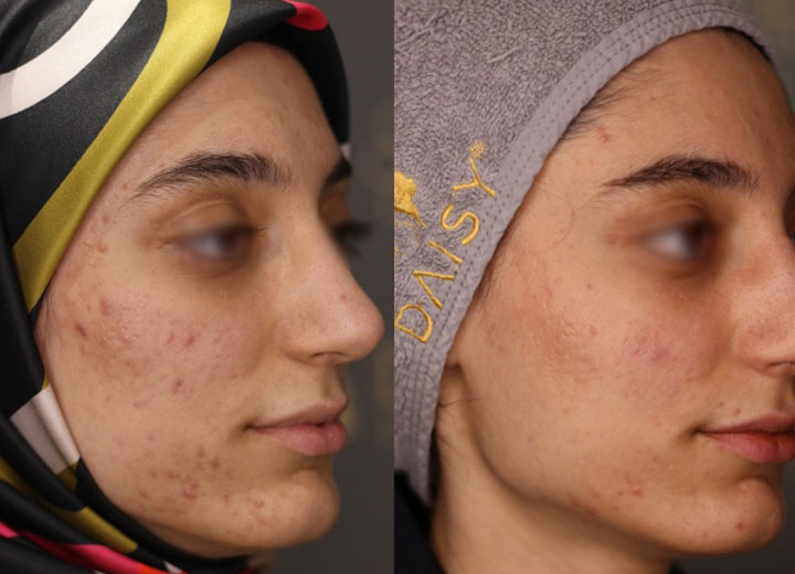 before-after