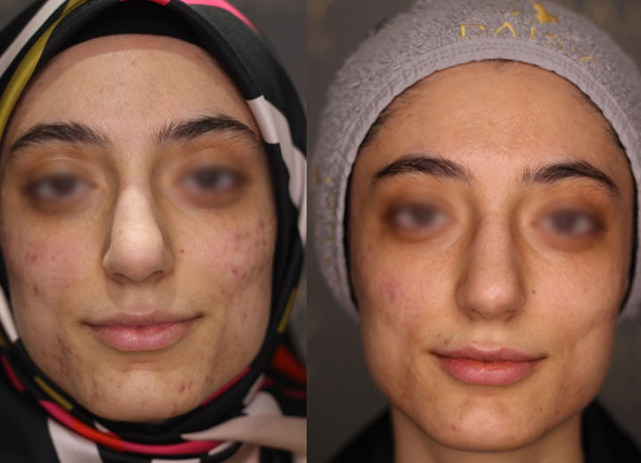before-after