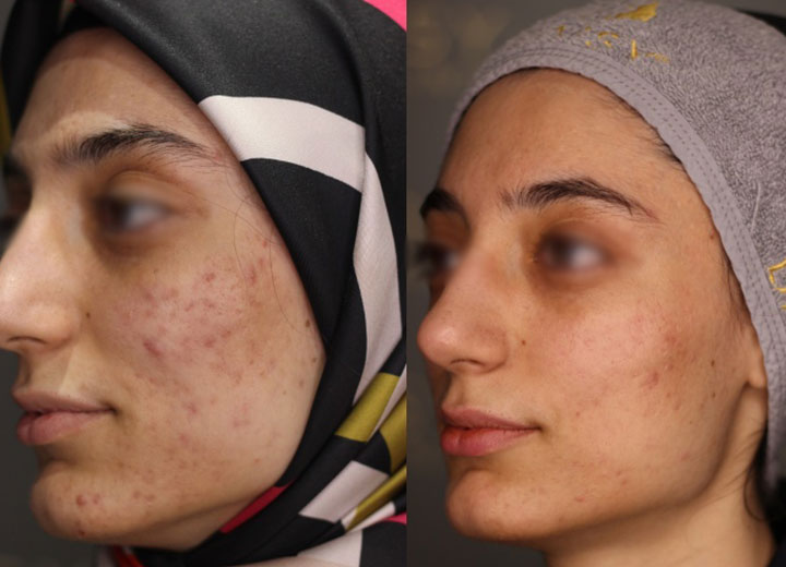 before-after
