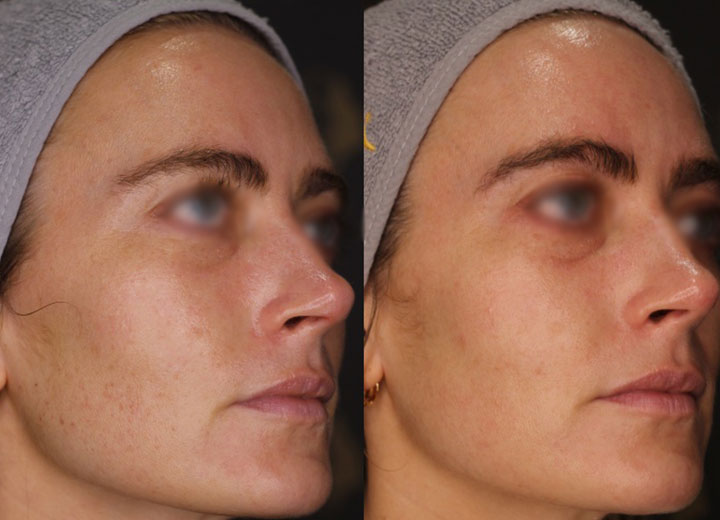 before-after